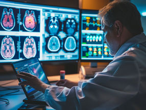 AI-supported image analysis: metrics determine quality